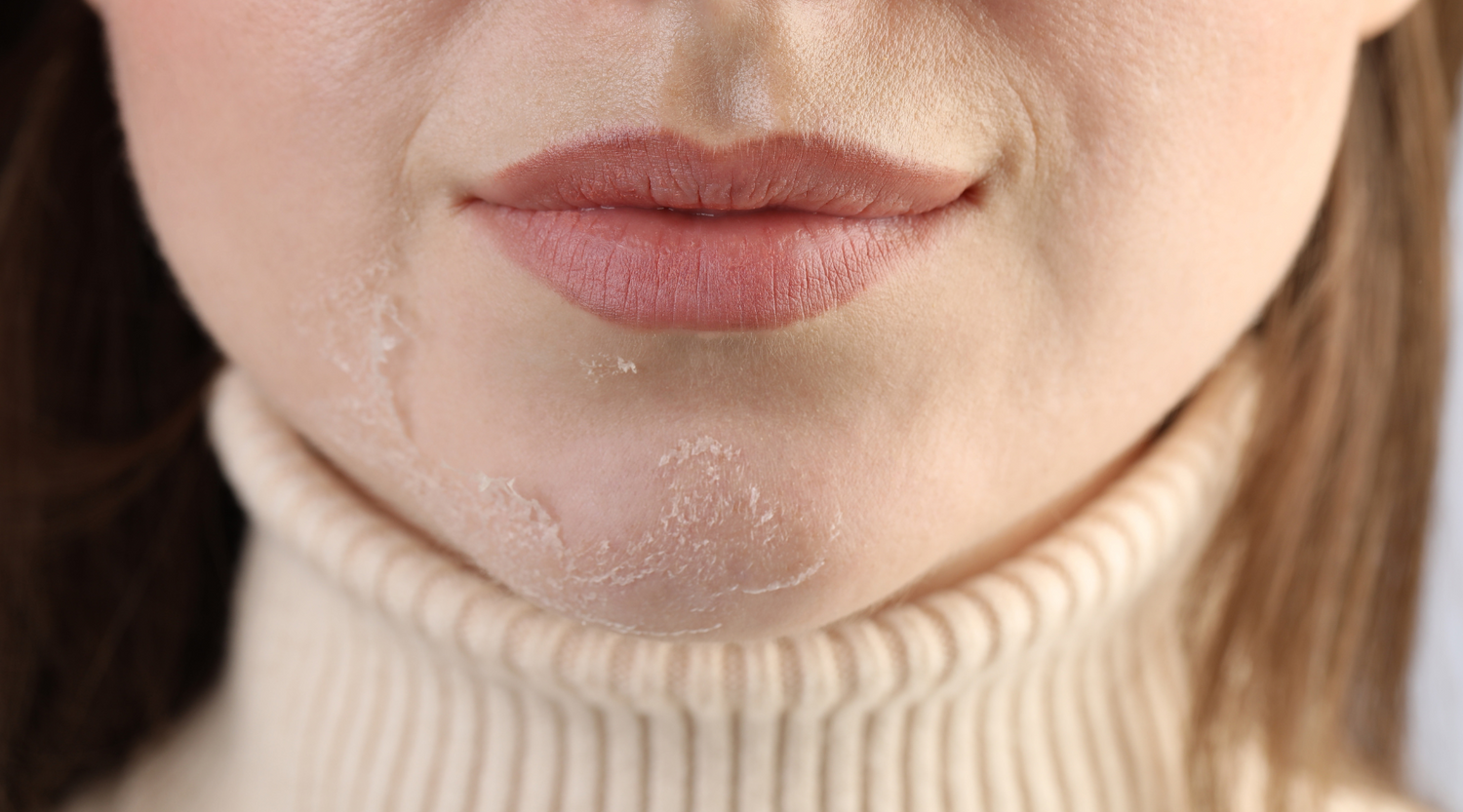 Sensitive Skin